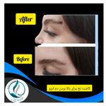 مرکزکلینیک لیزر زیبایی پوست و مو آسا