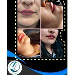 مرکزکلینیک لیزر زیبایی پوست و مو آسا