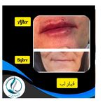 مرکزکلینیک لیزر زیبایی پوست و مو آسا