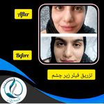 مرکزکلینیک لیزر زیبایی پوست و مو آسا