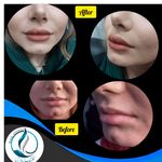 مرکزکلینیک لیزر زیبایی پوست و مو آسا