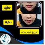 مرکزکلینیک لیزر زیبایی پوست و مو آسا