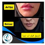 مرکزکلینیک لیزر زیبایی پوست و مو آسا