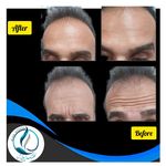 مرکزکلینیک لیزر زیبایی پوست و مو آسا