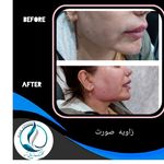 مرکزکلینیک لیزر زیبایی پوست و مو آسا