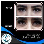 مرکزکلینیک لیزر زیبایی پوست و مو آسا