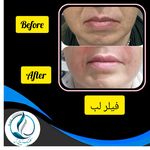 مرکزکلینیک لیزر زیبایی پوست و مو آسا
