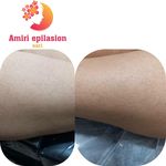 اپیلاسیون تخصصی بدن بانوان در ساری