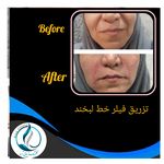 مرکزکلینیک لیزر زیبایی پوست و مو آسا