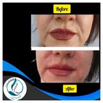 مرکزکلینیک لیزر زیبایی پوست و مو آسا