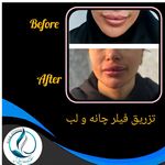 مرکزکلینیک لیزر زیبایی پوست و مو آسا