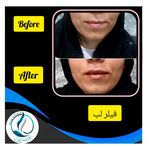 مرکزکلینیک لیزر زیبایی پوست و مو آسا