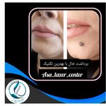 مرکزکلینیک لیزر زیبایی پوست و مو آسا