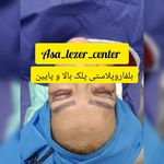 مرکزکلینیک لیزر زیبایی پوست و مو آسا