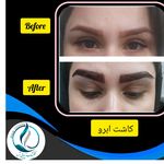 مرکزکلینیک لیزر زیبایی پوست و مو آسا