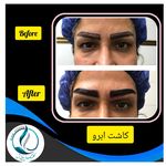 مرکزکلینیک لیزر زیبایی پوست و مو آسا