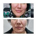 مرکزکلینیک لیزر زیبایی پوست و مو آسا