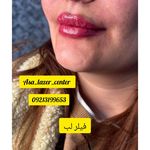 مرکزکلینیک لیزر زیبایی پوست و مو آسا