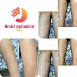 اپیلاسیون تخصصی بدن بانوان در ساری