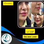 مرکزکلینیک لیزر زیبایی پوست و مو آسا