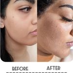 پاکسازی پوست مائده