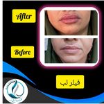 مرکزکلینیک لیزر زیبایی پوست و مو آسا