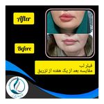 مرکزکلینیک لیزر زیبایی پوست و مو آسا