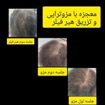 مرکزکلینیک لیزر زیبایی پوست و مو آسا