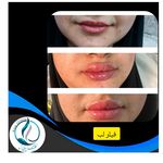 مرکزکلینیک لیزر زیبایی پوست و مو آسا