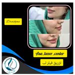 مرکزکلینیک لیزر زیبایی پوست و مو آسا