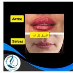 مرکزکلینیک لیزر زیبایی پوست و مو آسا