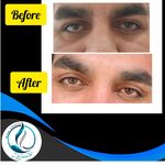 مرکزکلینیک لیزر زیبایی پوست و مو آسا