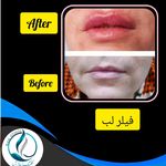 مرکزکلینیک لیزر زیبایی پوست و مو آسا