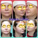 کلینیک پوست ،مو و زیبایی کسرا