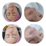 پاکسازی پوست