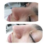 پاکسازی پوست