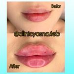 مطب پوست ،مو و لیزر یسنا طب