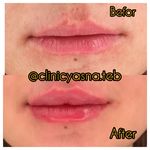 مطب پوست ،مو و لیزر یسنا طب