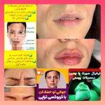 کلینیک زیبایی ملکه پارس