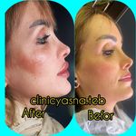 مطب پوست ،مو و لیزر یسنا طب