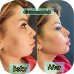 مطب پوست ،مو و لیزر یسنا طب