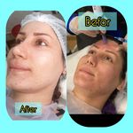 مطب پوست ،مو و لیزر یسنا طب