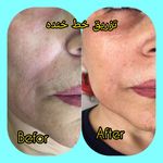 مطب پوست ،مو و لیزر یسنا طب