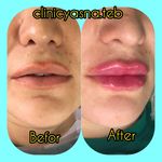 مطب پوست ،مو و لیزر یسنا طب