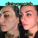 مطب پوست ،مو و لیزر یسنا طب