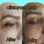 مطب پوست ،مو و لیزر یسنا طب