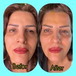 مطب پوست ،مو و لیزر یسنا طب