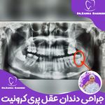 مطب دندانپزشکی دکتر زهرا باقری