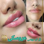 مرکز لیزر کلینیک زیبایی دکتر نگار وکیلی