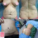 مطب دکتر کیوان مهدی نژاد ، جراح زیبایی ، تیروئید  و لاپاراسکوپی